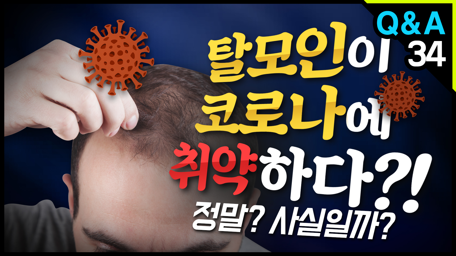 영상 썸네일